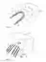 Fig. 15 - Elements for versatility of a prosthetic anchor