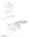 Fig. 25 - Elements for versatility of a prosthetic anchor