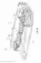 Fig. 18 - Selective tissue removal tool for use in medical applications and methods for making and using