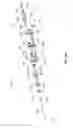 Fig. 57 - Selective tissue removal tool for use in medical applications and methods for making and using