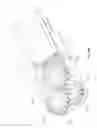 Fig. 71 - Selective tissue removal tool for use in medical applications and methods for making and using
