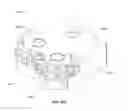 Fig. 75 - Selective tissue removal tool for use in medical applications and methods for making and using