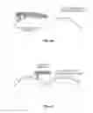 Fig. 86 - Selective tissue removal tool for use in medical applications and methods for making and using