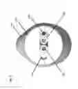 Fig. 03 - System for treating the prostate