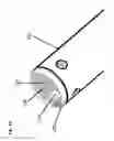 Fig. 17 - System for treating the prostate