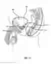 Fig. 18 - System for treating the prostate