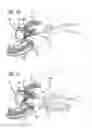 Fig. 19 - System for treating the prostate