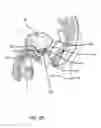 Fig. 20 - System for treating the prostate