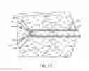 Fig. 11 - Methods and devices for removing tissue from a patient and placing a marker in the patient