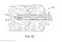 Fig. 16 - Methods and devices for removing tissue from a patient and placing a marker in the patient