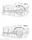 Fig. 05 - Method of performing a suprapubic transurethral cystostomy