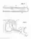 Fig. 06 - Method of performing a suprapubic transurethral cystostomy