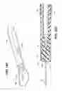Fig. 13 - Method of performing a suprapubic transurethral cystostomy