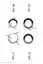Fig. 02 - BALLOON CATHETER COMPRISING A RADIALLY ASYMMETRICALLY DILATABLE PORTION