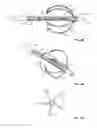 Fig. 04 - Percutaneous retrievable vascular filter