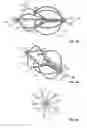 Fig. 05 - Percutaneous retrievable vascular filter