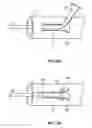 Fig. 09 - Percutaneous retrievable vascular filter