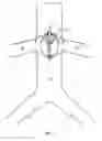 Fig. 10 - Percutaneous retrievable vascular filter