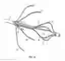 Fig. 14 - Percutaneous retrievable vascular filter