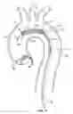 Fig. 07 - Embolic protection device