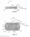 Fig. 08 - Embolic protection device