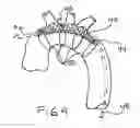 Fig. 05 - Embolic protection device