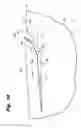 Fig. 05 - Wound closure device including barbed pins