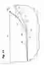 Fig. 06 - Wound closure device including barbed pins
