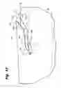 Fig. 07 - Wound closure device including barbed pins