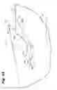 Fig. 08 - Wound closure device including barbed pins