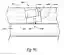 Fig. 16 - Methods and systems for establishing hemostasis relative to a puncture
