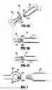 Fig. 05 - Modular suture