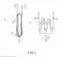 Fig. 04 - Suspensory graft fixation with adjustable loop length