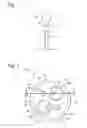 Fig. 02 - Suture locks and suture lock systems