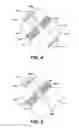Fig. 04 - Facet device and method