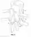 Fig. 05 - Facet device and method
