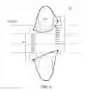 Fig. 13 - METHODS AND DEVICES FOR RESTRICTING FLEXION AND EXTENSION OF A SPINAL SEGMENT