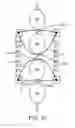 Fig. 14 - METHODS AND DEVICES FOR RESTRICTING FLEXION AND EXTENSION OF A SPINAL SEGMENT