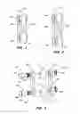 Fig. 02 - INTERSEGMENTAL MOTION PRESERVATION SYSTEM FOR USE IN THE SPINE AND METHODS FOR USE THEREOF