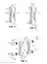 Fig. 03 - INTERSEGMENTAL MOTION PRESERVATION SYSTEM FOR USE IN THE SPINE AND METHODS FOR USE THEREOF