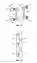 Fig. 06 - INTERSEGMENTAL MOTION PRESERVATION SYSTEM FOR USE IN THE SPINE AND METHODS FOR USE THEREOF