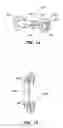 Fig. 07 - INTERSEGMENTAL MOTION PRESERVATION SYSTEM FOR USE IN THE SPINE AND METHODS FOR USE THEREOF