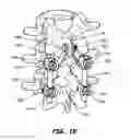 Fig. 08 - INTERSEGMENTAL MOTION PRESERVATION SYSTEM FOR USE IN THE SPINE AND METHODS FOR USE THEREOF