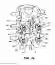 Fig. 09 - INTERSEGMENTAL MOTION PRESERVATION SYSTEM FOR USE IN THE SPINE AND METHODS FOR USE THEREOF