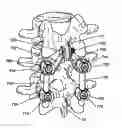 Fig. 01 - INTERSEGMENTAL MOTION PRESERVATION SYSTEM FOR USE IN THE SPINE AND METHODS FOR USE THEREOF