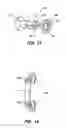 Fig. 07 - INTERSEGMENTAL MOTION PRESERVATION SYSTEM FOR USE IN THE SPINE AND METHODS FOR USE THEREOF