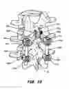 Fig. 08 - INTERSEGMENTAL MOTION PRESERVATION SYSTEM FOR USE IN THE SPINE AND METHODS FOR USE THEREOF
