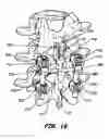 Fig. 09 - INTERSEGMENTAL MOTION PRESERVATION SYSTEM FOR USE IN THE SPINE AND METHODS FOR USE THEREOF