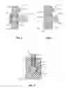 Fig. 03 - SPINOUS PROCESS IMPLANT WITH EXTENDED POST