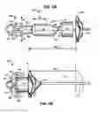 Fig. 05 - Systems and methods for in situ assembly of an interspinous process distraction implant